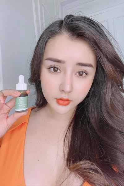 serum Serum trị mụn thâm và se khít lỗ chân lông Igreen