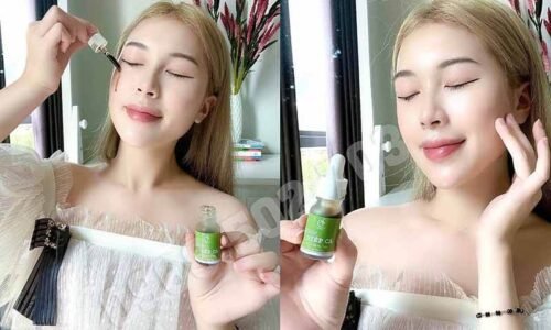 19 câu hỏi liên quan đến sản phẩm serum diếp cá igreen