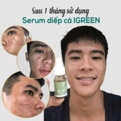 Serum trị mụn diếp cá igreen - Sạch mụn hết thâm