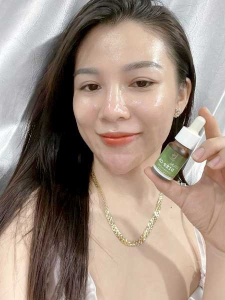 Serum trị mụn diếp cá igreen - Sạch mụn hết thâm