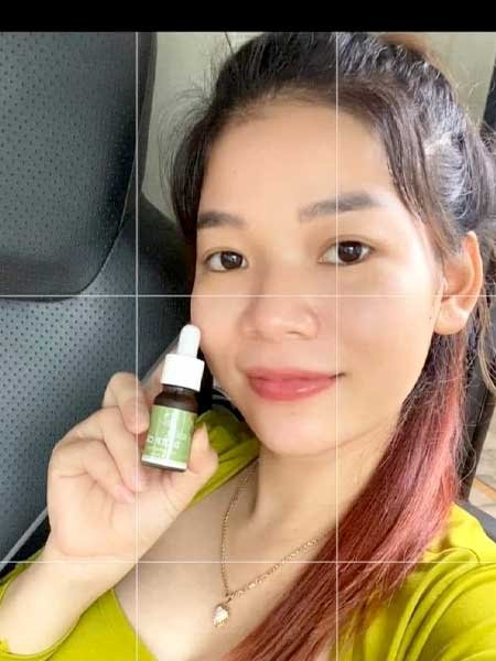 Serum trị mụn diếp cá igreen - Sạch mụn hết thâm