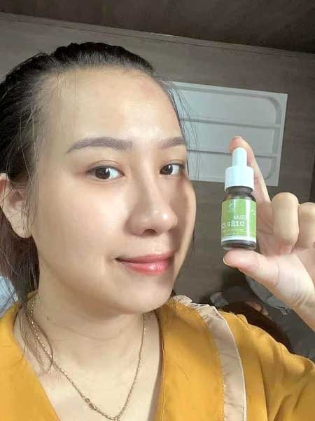 Serum trị mụn diếp cá igreen - Sạch mụn hết thâm