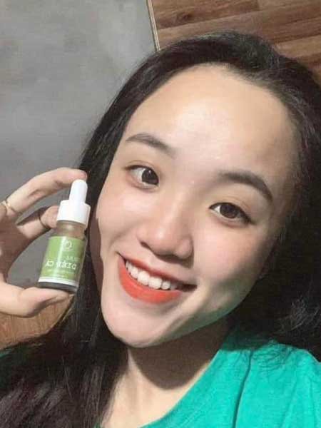 Serum trị mụn diếp cá igreen - Sạch mụn hết thâm